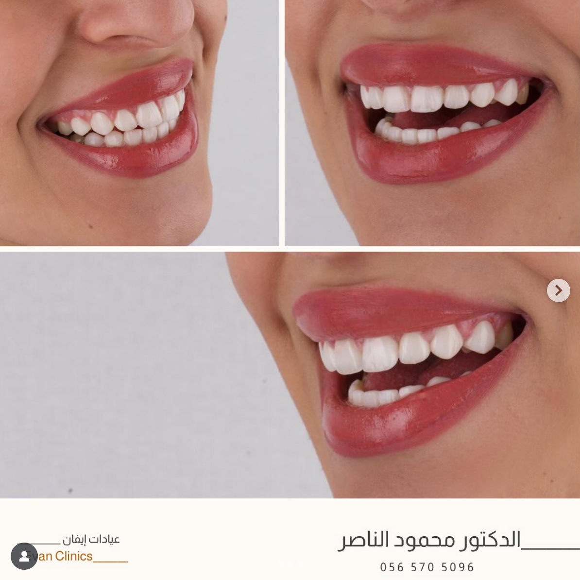 Screenshot 2025-08-25 at 8.45.23 PM