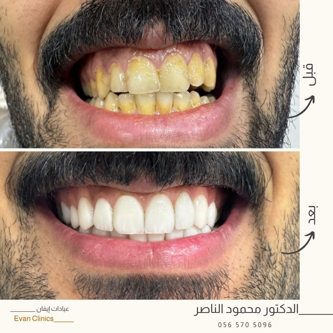 WhatsApp Image 2025-08-19 at 17.22.23 (1)